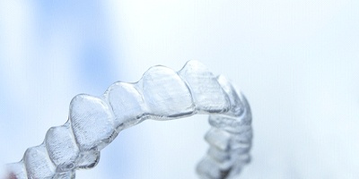 Single ClearCorrect aligner against a clear blue background