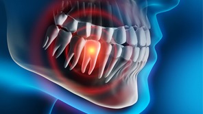 computer illustration of a person with a toothache that needs to be treated by a dentist in Anthem
