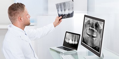 Dentist comparing X-rays of integrated dental implants in Anthem.