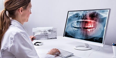 Dentist examining an X-ray of a failing dental implant in Anthem.