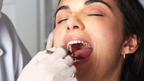 relaxed woman getting teeth examination