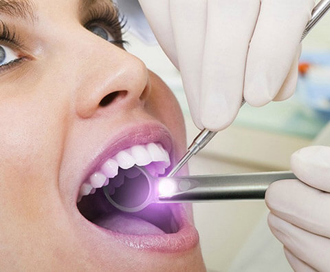 Woman being examined with dental mirror