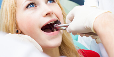 Young woman having wisdom tooth removed